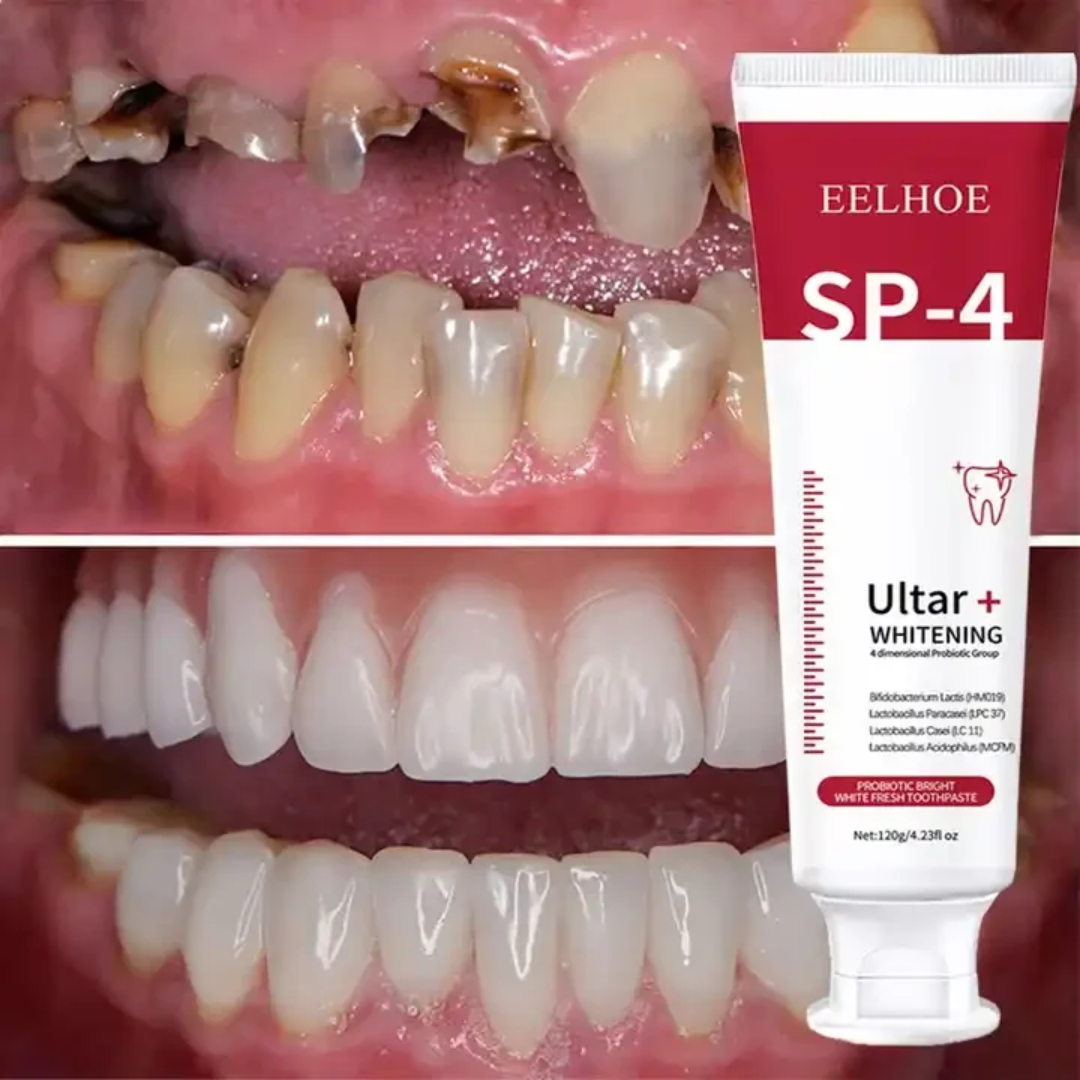 🦷 Dites Adieu aux Dents Jaunes et à la Mauvaise Haleine Avec la Pâte SP-4 Ultra+✅️